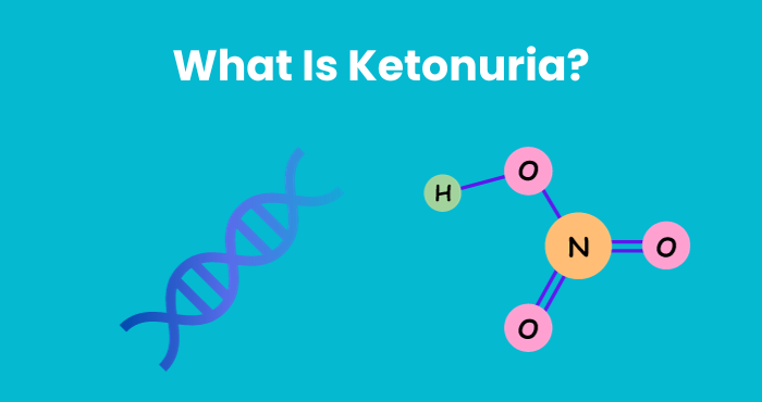 What Is Ketonuria?
