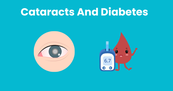 Cataracts And Diabetes